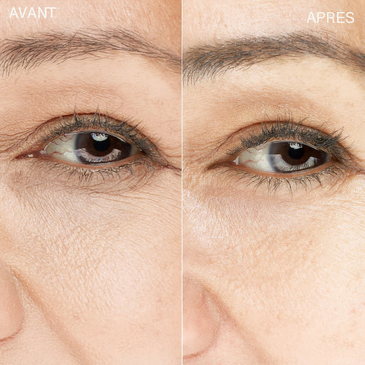 Crème pour le contour des yeux